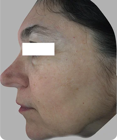 تيسلا B&amp;A موديل 2 قبل 1 1 (2)