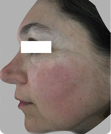 تيسلا B&amp;A موديل 2 قبل 1 1 (3)